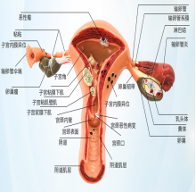 MÔ HÌNH BỆNH LÝ TỬ CUNG VÀ BUỒNG TRỨNG NỮ